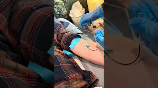 Insertion of closed catheter IV and saline flush demonstration [upl. by Ainoek]