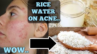 I Tested Rice Water for 1 Week Straight  SHOCKED BY THE RESULTS THIS IS HOW MY SKIN LOOKS NOW [upl. by Eatnahs326]