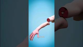 Watch a bionic arm implant Credits for zackdfilms [upl. by Tamiko316]