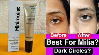 Minimalist 1 Retinol Under Eye Cream Review  BEST Retinol Under Eye Cream✅For MiliaDark circles [upl. by Schulze]