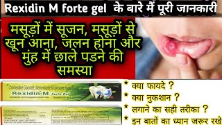 RexidinM Forte Gel  Review and Benefits  Rexidin m forte gel how to use [upl. by Mateo165]