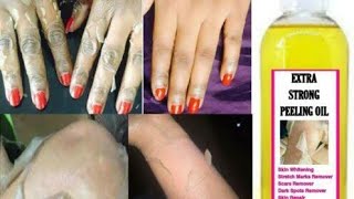 Yellow peeling oil Review In Bangla  ৩শেড ফর্সাকারী পিলিং ওয়েল। [upl. by Hardunn369]