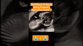 Fetal death😭side effects of vaping during pregnancy😭🙏viralvideo trending viralshorts [upl. by Eirek]