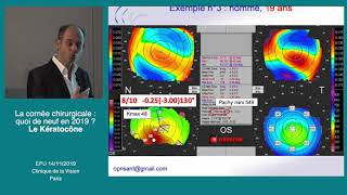 Conférence keratocone Docteur Olivier Prisant EPU Clinique de la Vision 2019 [upl. by Aracahs]