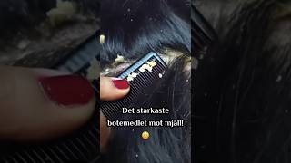 Det starkaste botemedlet mot mjäll 😳 MORINZ bioderma men women MÖRINZ beautybysweden fyp [upl. by Antipus]