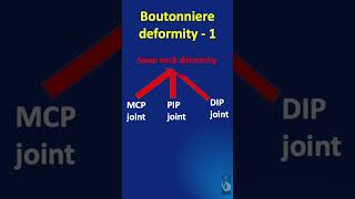 Shorts 83 Boutonniere deformity  what is it Explained in less than a minute [upl. by Tacye]