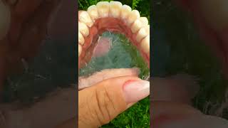 Healthy gingiva viralvideo dentist dentistryworld dentalcare satisfying orthodontist shorts [upl. by Matthias660]