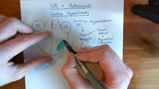 Cardiac Hypertrophy and the Sarcoplasmic Reticulum Part 1 [upl. by Adnalu]