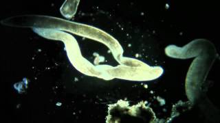 Spirostomum la conjugaison [upl. by Enahs]