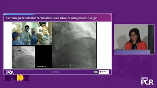 Ultralow contrast techniques to improve safety and quality of PCI in complex amp highrisk patients [upl. by Torry389]