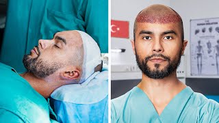 I Went To Turkey For A Hair Transplant [upl. by Adore]