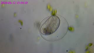 3 hours Timelapse of a Rotifers egg 100x speed [upl. by Eenerb]