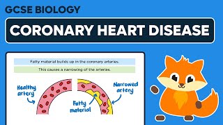 Coronary Heart Disease  GCSE Biology [upl. by Hanah]