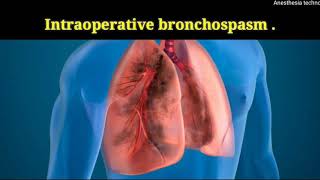 intraoperative bronchospasm [upl. by Benedetto]