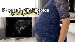 Pregnancy w Fibroids  35 Week Update [upl. by Roht600]