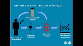 Multiple Myeloma – Is It Now a Curable Disease [upl. by Cioban]