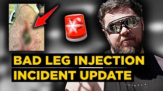 I almost had to amputate my leg LEG INJECTION HORROR STORY During pfspssdpasplms Recovery [upl. by Aicinet]