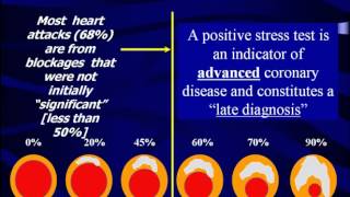 What Does Your Stress Test Really Mean  The Princeton Longevity Center [upl. by Dylan232]