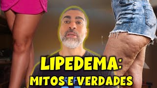 Lipidema mitos e verdades [upl. by Melesa]