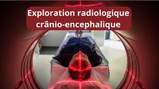 Exploration cranio encéphalique  TDM  IRM  AVC  hématomes  fractures crâniennes [upl. by Yarised]