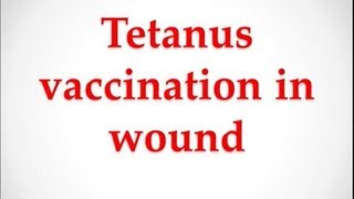 USMLE Medical Video Lectures about tetanus vaccination in wound by UsmleTeam [upl. by Amias]