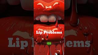 What Are the Most Common Lip Problems and How Can They Be Treated lips shorts fyp foryou [upl. by Fergus]