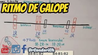 Que es el ritmo de galope en la auscultacion facil y sencillo [upl. by Ardine]