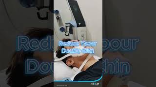 EMFACE Double Chin Reduction CliqueClinicMY [upl. by Acinoj]