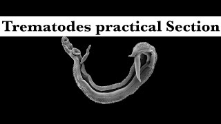 Parasitology practical part 1 Trematodes section [upl. by Sigismondo]