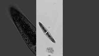 Closterium  Zieralgen  Desmidiales unter dem Mikroskop science algen 5 [upl. by Nalad]