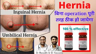 Homeopathic medicine for hernia hernia cure without surgery  hernia ka jad se ilaj [upl. by Kimmel648]