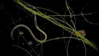 🔬 Nematoda  Fadenwurm  microorganism microcosmos under a dark field microscope Full HD [upl. by Oicneconi]