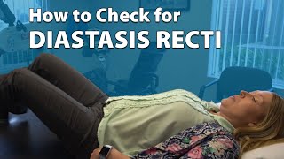 How to Check for Diastasis Recti [upl. by Flora]