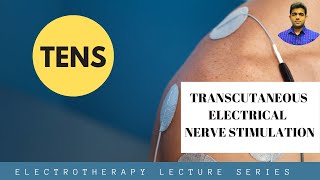 Transcutaneous Electrical Nerve Stimulation TENS  Electrotherapy lecture Part 1 [upl. by Anibur132]