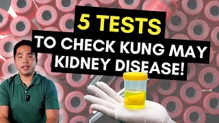 5 Tests Para Malaman Kung May Kidney Disease [upl. by Matronna]