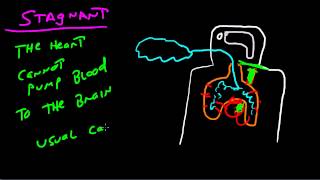 The Four Types Of Hypoxia [upl. by Eronel]