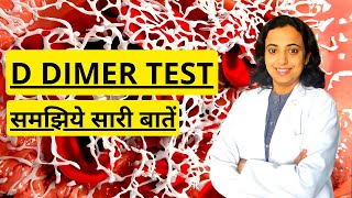 D Dimer Test Procedure in Hindi  What is D Dimer Test and How its Done [upl. by Ihcas393]