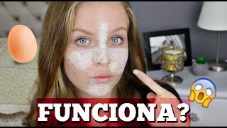 ELIMINA TUS PUNTOS NEGROS  MASCARILLA DE HUEVO  ¿FUNCIONA [upl. by Aiset]