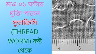 মাএ ০১ ঘন্টায় মুক্তি পাবেন সুতাক্রিমি THREAD WORM কষ্ট থেকেDrDelwar hossain [upl. by Ahsyen]