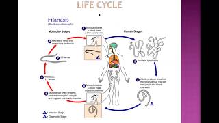 Filariasis [upl. by Meek610]