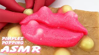 Pimple Popping on HyperRealistic Silicone Body Models 🛑Live Stream [upl. by Livvie]