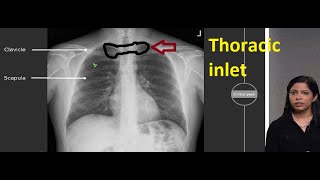 Structures passing through thoracic inlet [upl. by Pump]