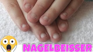 NAGELBEISSER EXTREM 😱 Tipps undAnleitung für Gelnägel Modellage  Lyninails [upl. by Arria954]