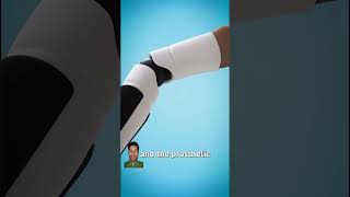 How A Bionic Arm Works 🤔 facts shorts [upl. by Zamir]