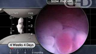 The Beating Heart in Slow Motion 4 12 Weeks Pregnant [upl. by Strade326]