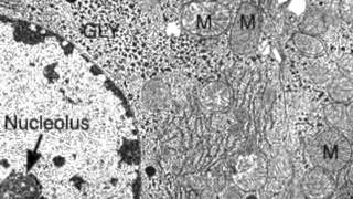 233 Identify structures from electron micrographs of liver cells [upl. by Lida777]