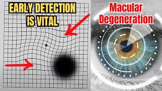 Detect Early Signs of Macular Degeneration with the Amsler Grid Test [upl. by Maxma]