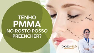 Pacientes com PMMA como preencher [upl. by Ecaidnac]