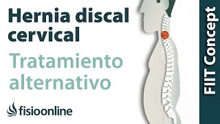 Hernia discal cervical izquierda por disfunción de vesícula biliar Plantas medicinales [upl. by Burn]