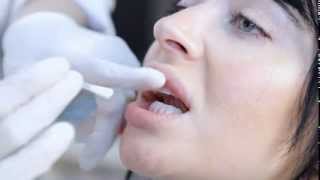 15minute Inoffice Whitening Procedure [upl. by Nylac]